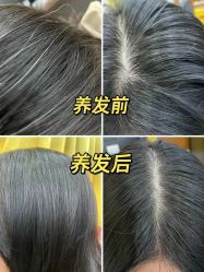 -希梵尔头皮抗衰·科技养发