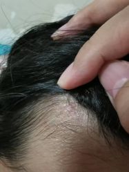 -北京美痣堂古方祛痣斑疣瘊