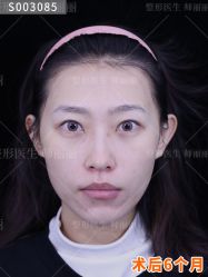 -丰联丽格医疗美容·联合丽格眼整形中心