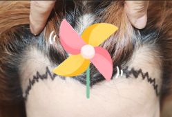 -大麦微针植发全国连锁