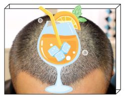 -大麦微针植发全国连锁