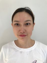 体验前-北京炫美医疗美容