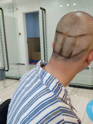 -雍禾植发全国连锁