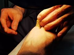 -世龙世家灰指甲鸡眼脚气甲沟炎跖疣护理(通州店)