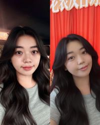 -广州健丽·去眼袋医疗美容机构