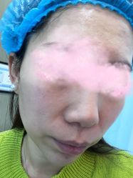 体验前-澳尔颜选医疗美容