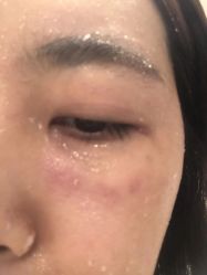 -新美荟医美·专注面部美学抗衰