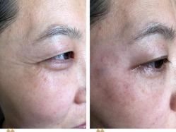 -Cream88颜皮肤管理中心