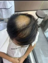 -唐风采假发补发定制