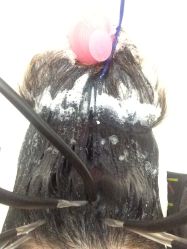 奶疗进行中-再出发防脱发白发理疗中心