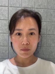 体验前-上海时光整形外科医院
