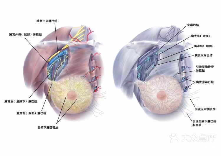 乳腺淋巴位置图片大全图片