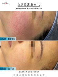 -黎蓓露·徒手骨雕蛋白抗衰·调肤管理