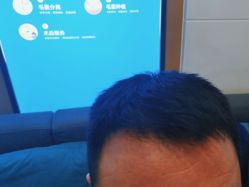 -雍禾植发全国连锁