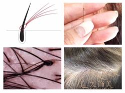 点击看大图 -发饰美男士增发补发假发定制店