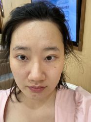体验后-南京康美美容医院·旗舰店