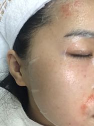 体验后-JUVA郑州欧华医疗美容医院