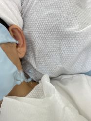 -悟空祛痘·诺奖技术专业店