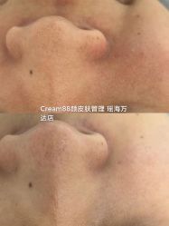 -Cream88颜皮肤管理中心