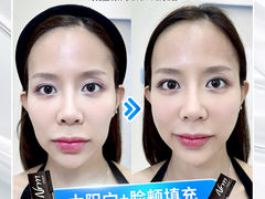 -暹罗广场