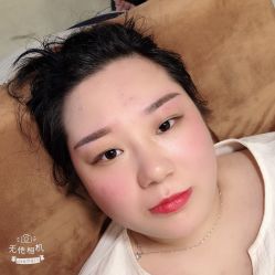 点击看大图 -郡艺医疗美容·微整·眼鼻吸脂