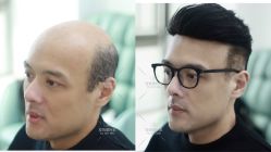 -发饰美男士增发补发假发定制店