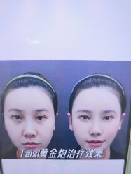 -郡艺医疗美容·微整·眼鼻吸脂