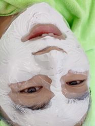 点击看大图 -苗医生0感科技祛痘