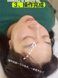 -清疣美疣·痣·斑净肤中心