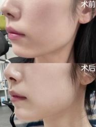 -广州美莱医疗美容医院