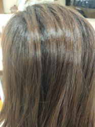 -碧莲盛·不剃发植发