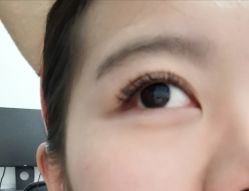 -初樱科技美学问题肌修复中心