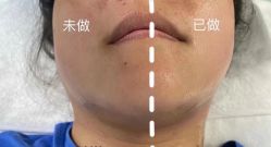 -LUNA皮相美·骨相美高级美感