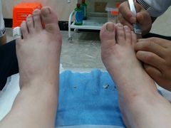 -郑远元专业修脚房(国顺东路店)