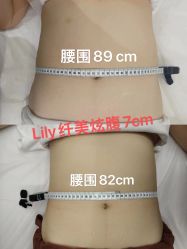 -Lily纤美·科技减脂中心