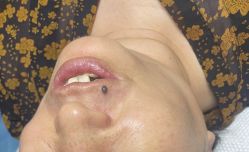 -清疣美疣·痣·斑净肤中心