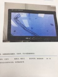 -派恩宜灰指甲鸡眼嵌甲手足癣