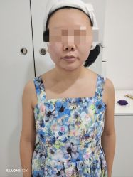 体验后-上海首尔丽格医疗美容医院