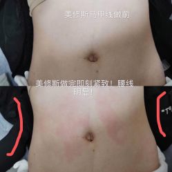 -科技美容&形体美修斯瘦身中心