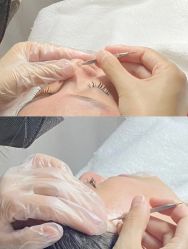 -Younger Skin·科技氧肤中心