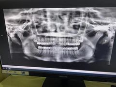 -宁波壹加壹口腔·矫正种植中心