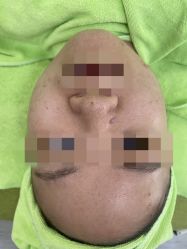 -苗医生草本科技祛痘