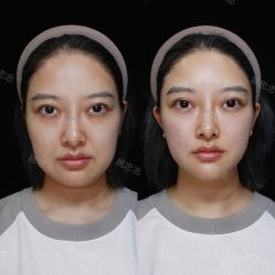 -深圳艺星医疗美容医院