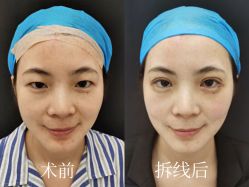 点击看大图 -轻辰医美