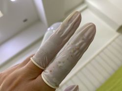 -苗医生草本科技祛痘