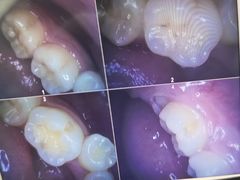 -牙博士口腔品牌连锁(杨浦店)