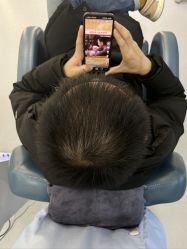 -大麦微针植发全国连锁