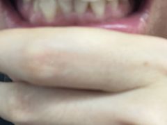 -微笑牙科口腔(三亚迎宾院区)