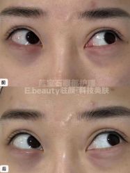 -E.beauty驻颜·痘敏肌调理中心
