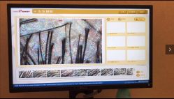 -大麦微针植发丨全国连锁